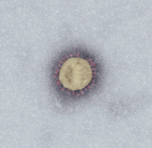 SARS-Coronavirus-2 (SARS-CoV-2, Isolat SARS-CoV-2/Italy-INMI1). Elektronenmikroskopie, Negativkontrastierung (PTA). Maßstab: 100 nm. Quelle: Tobias Hoffmann, Michael Laue, Robert Koch-Institut (RKI), 2020. SARS-Coronavirus-2 (SARS-CoV-2, Isolate SARS-CoV-2/Italy-INMI1). Negative staining electron microscopy, PTA staining. Scale bar: 100 nm. Source: Tobias Hoffmann, Michael Laue, Robert Koch Institute (RKI), 2020. Quelldatei: #6532_04_SARS-CoV-2_DOG_PTA_CCD_33.tif